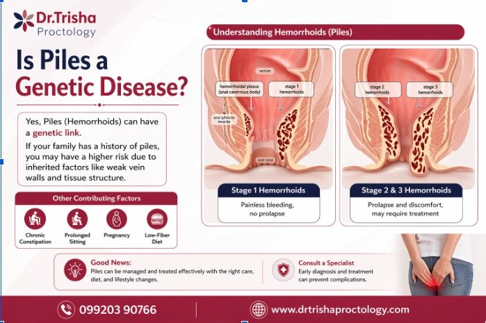 Is Piles a Genetic Disease?