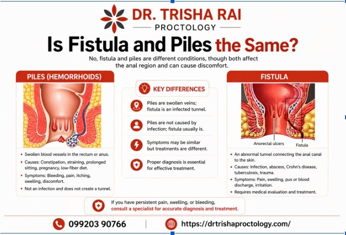 Is Fistula and Piles the Same?