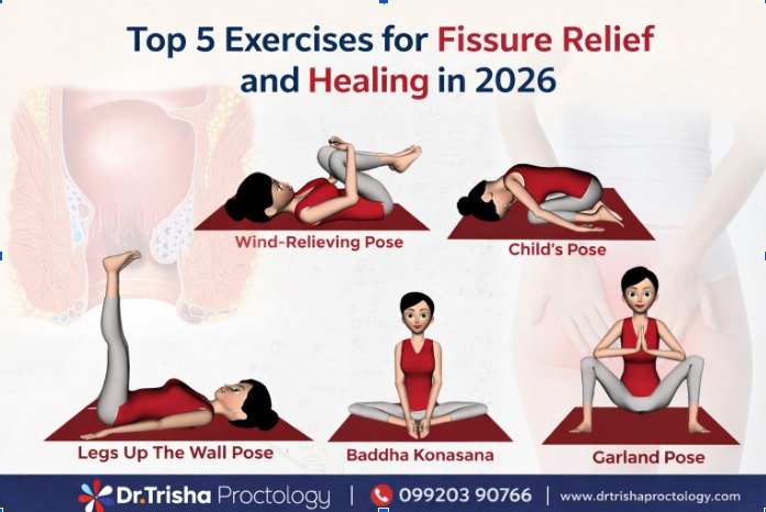 Top 5 Exercises for Fissure Relief and Healing in 2026