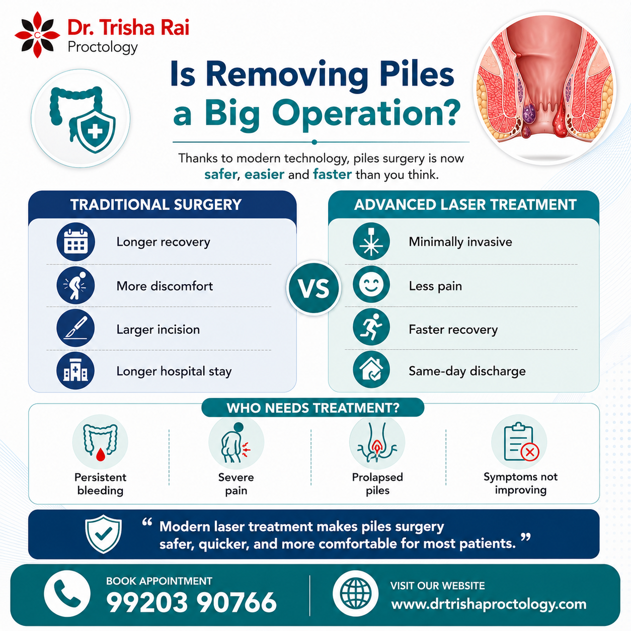 Is removing piles a big operation?