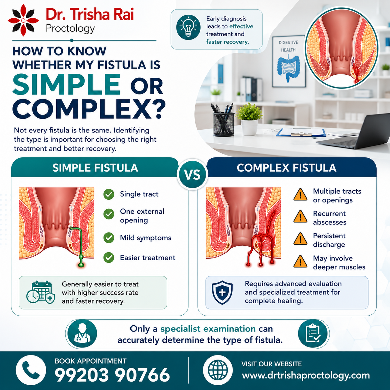How to Know Whether My Fistula is Simple or Complex?