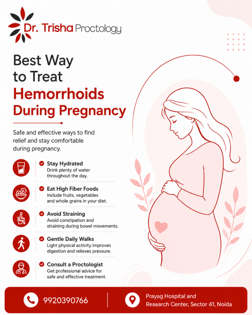 Best Way to Treat Hemorrhoids During Pregnancy